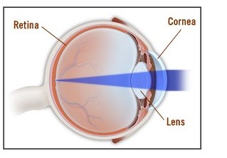 How does the normal eye sees.jpg