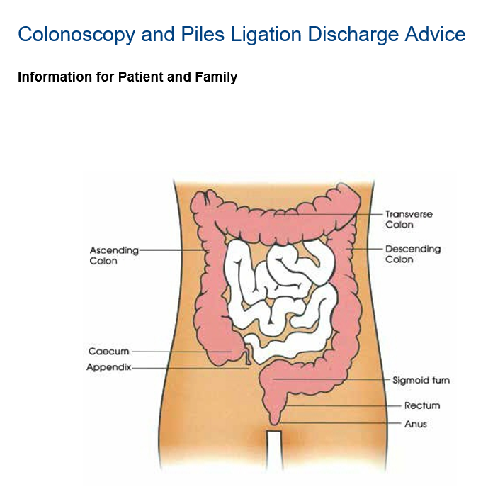 Colonoscopy and Piles Ligation English