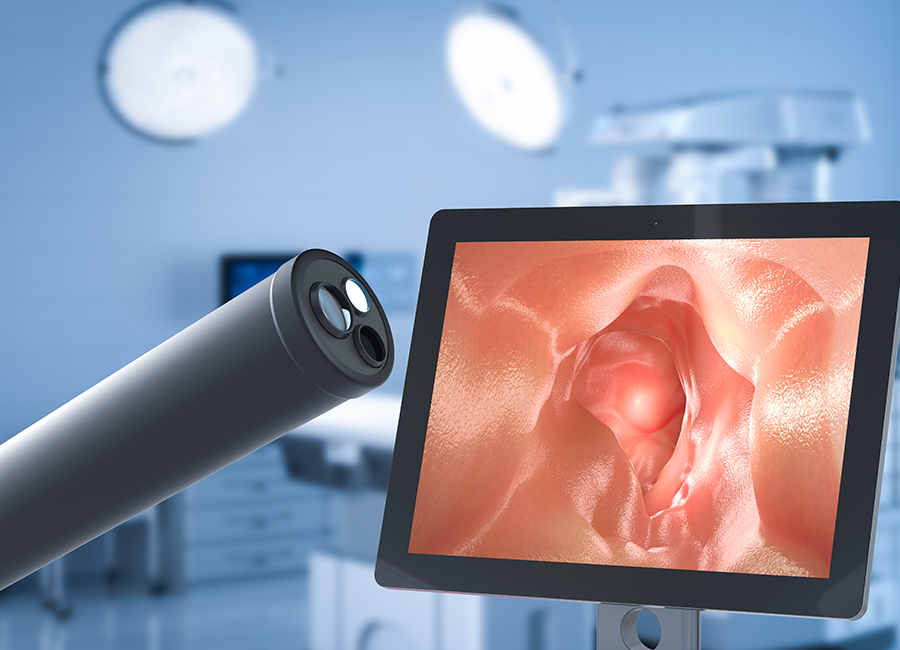 Colonoscopy