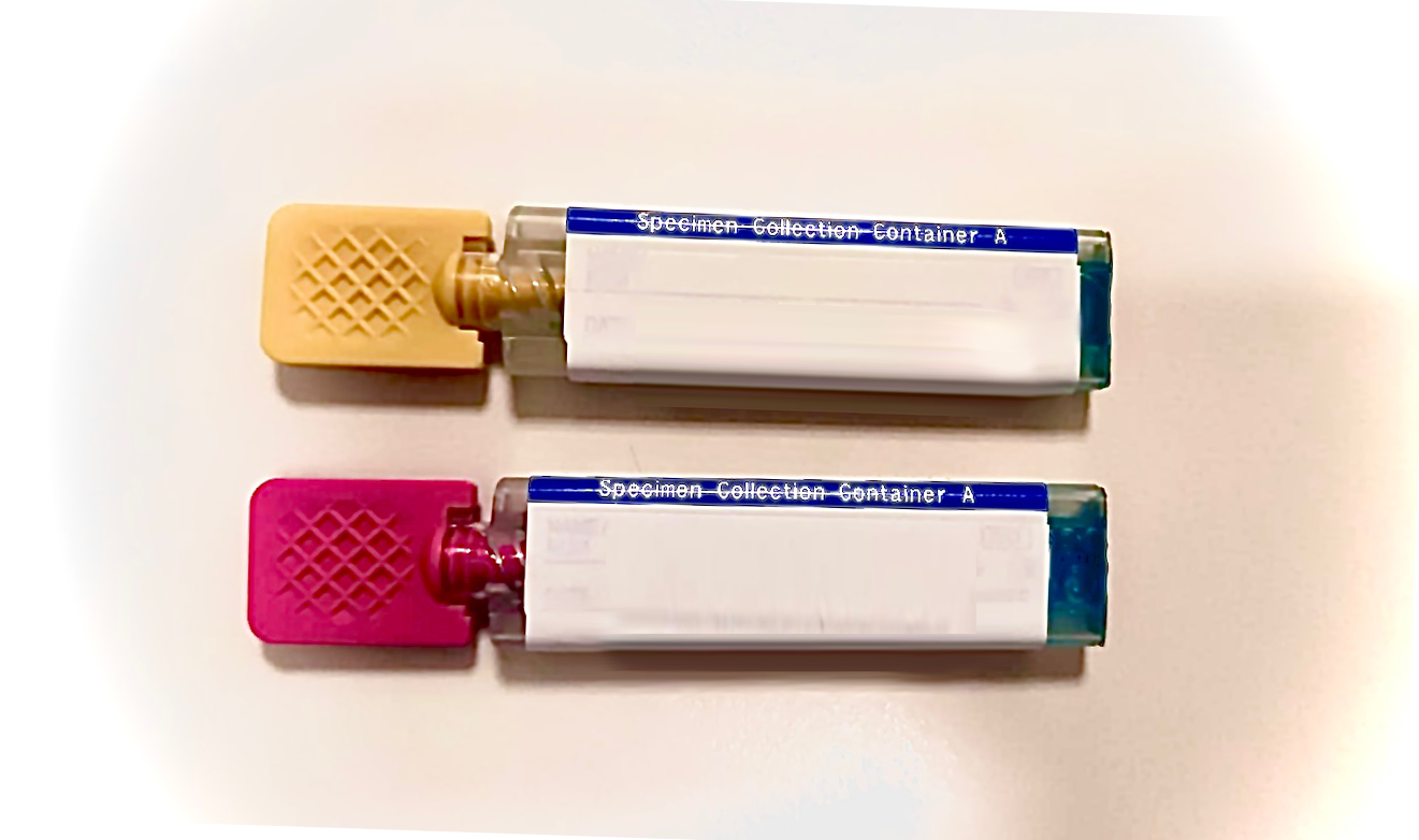Faecal Immunohistochemical Test