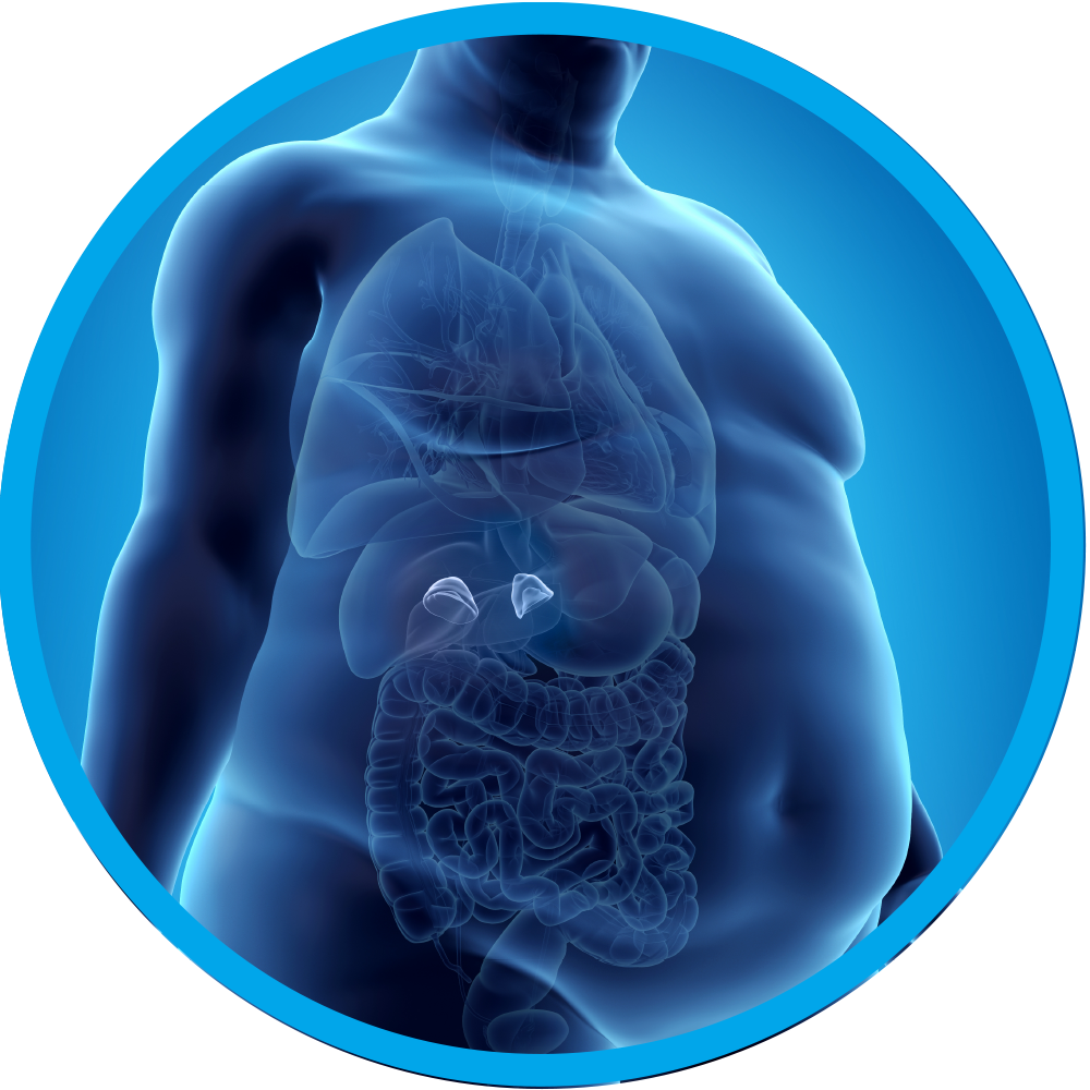 Obesity Managment & Surgery