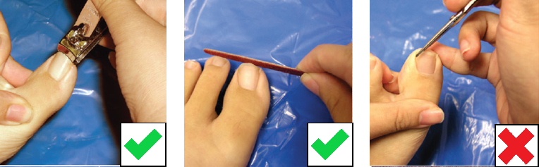 Cutting your nails