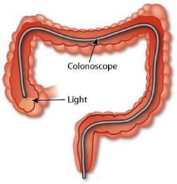 Colonoscope