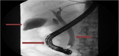 X-ray