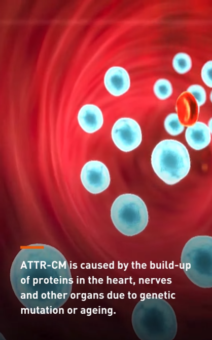 clinical trial based on gene-editing technology for patients of a rare disease 