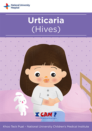 Urticaria (Hives)