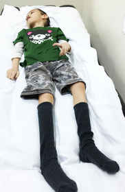 Patient 1 with postures support system