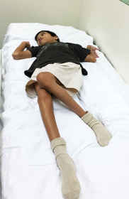 Patient 2 with postures support system