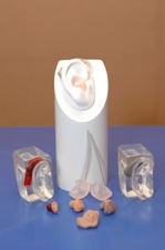 Cochlear Implant Surgery