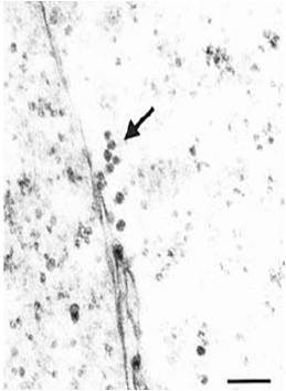 Hepatitis C virus