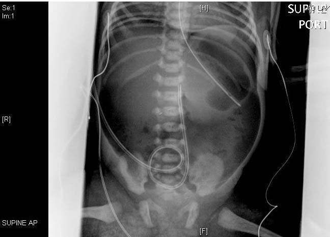 NEC X-ray
