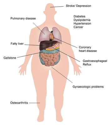 Co-morbidities