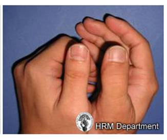 Big Toe Transfer