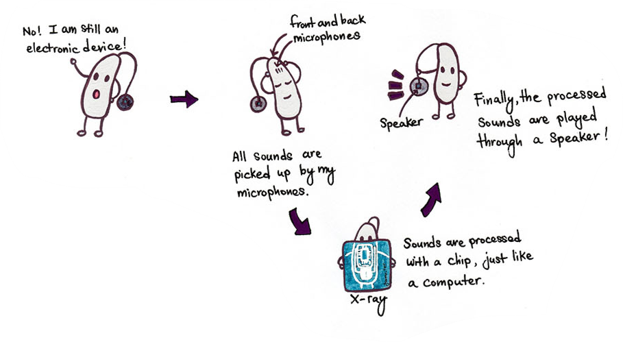 Hearing aids