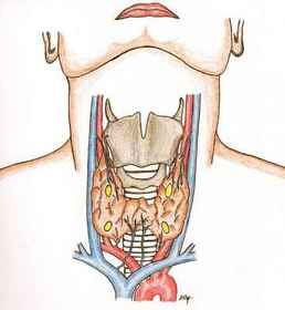 Thyroid
