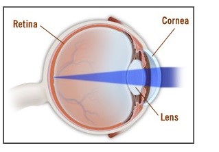 How does the normal eye sees