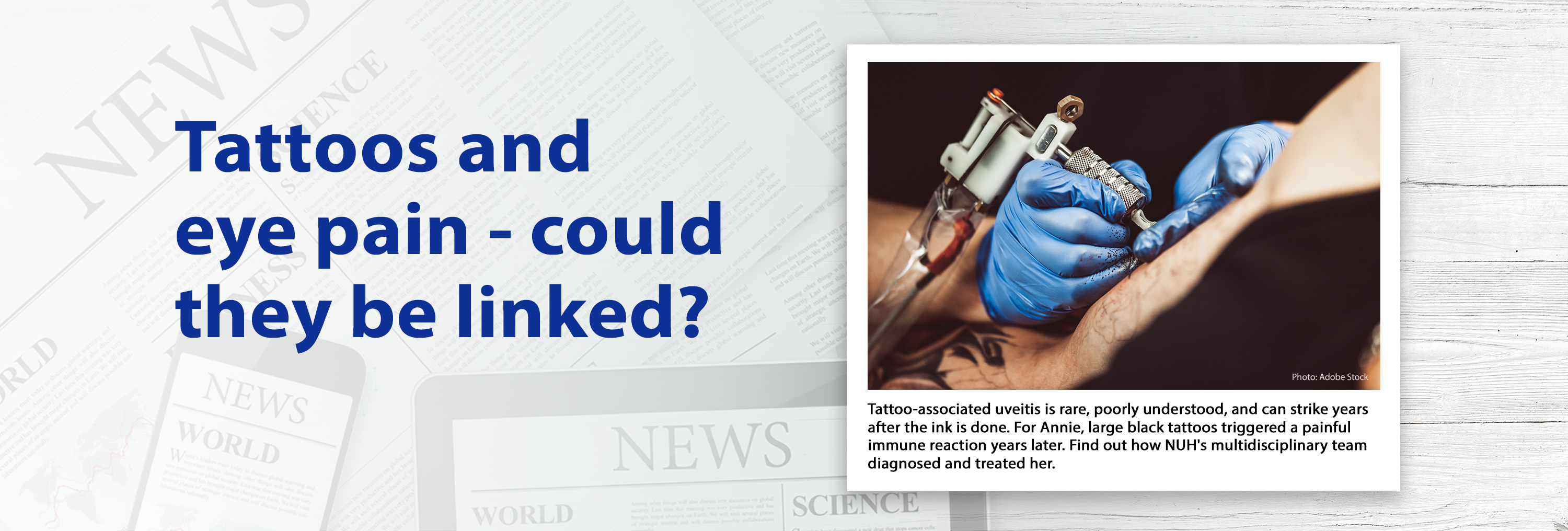 Tattoo-Associated Uveitis