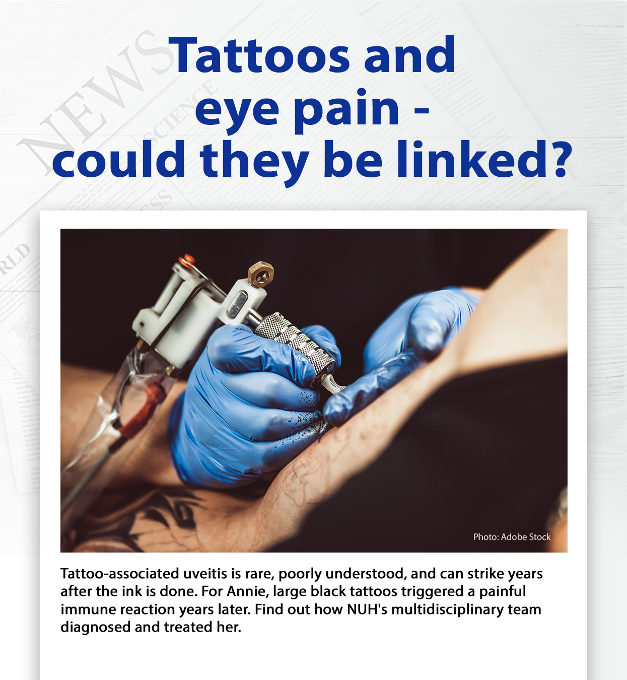 Tattoo-Associated Uveitis