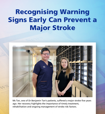 TIA stroke news