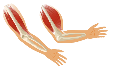 Arm