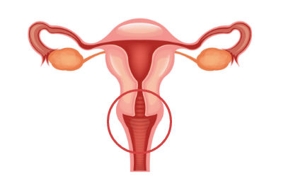 Cervix