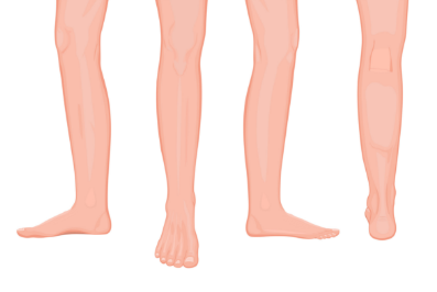 Leg