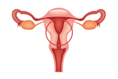 Uterus