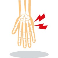 hand therapy (fracture).jpg