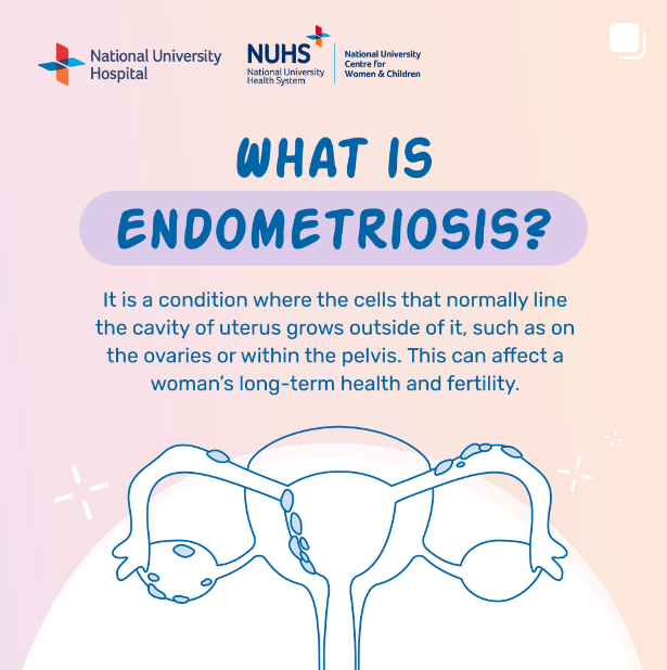 Endometriosis.png